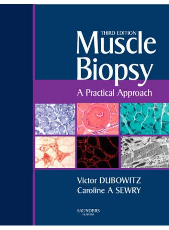 Muscle Biopsy: A Practical Approach