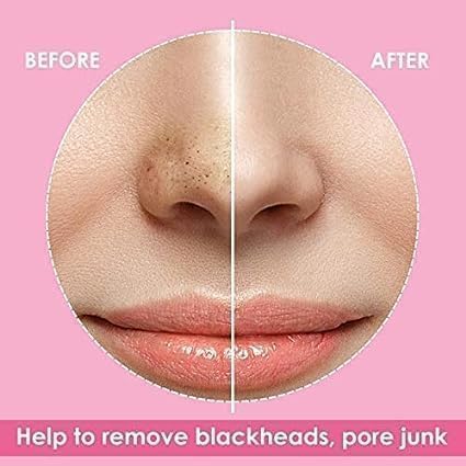 Luxenwell Deep Purifying Nose Strips for Women & Men | Enriched with Bamboo Charcoal | For Instant And Painless Blackheads And Whiteheads Removal (Pack of 10) - Image 4