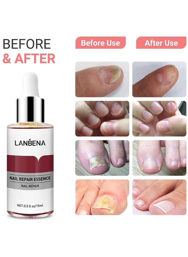LANBENA LANBENA Nail Repair Essence, Nails Repair Essence Nail Repair for Damaged Nails Protect Nail from Damage Fingernail and Toenail Repair for Curing Nail from Infection Discolored and Damaged Nails  - Image 3