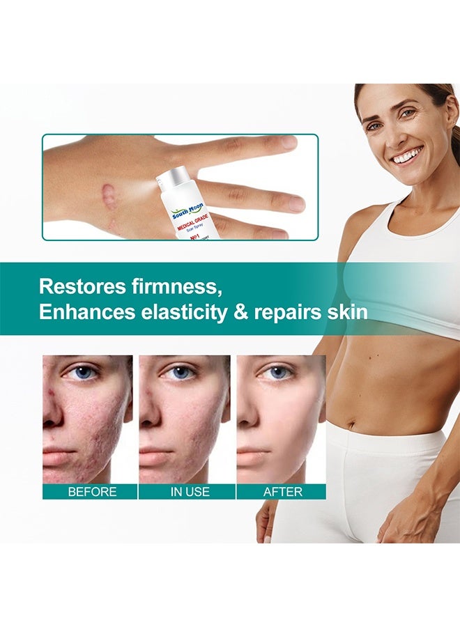 ساوث مون رذاذ ندبة طبي ، يعمل على جميع أنواع الندبات ، تجديد الخلايا ، تنشيط الكولاجين ، تجديد البشرة ، تنعيم البشرة ، رذاذ للعناية بالبشرة يرطب البشرة ، رذاذ 20 جرام - Image 5