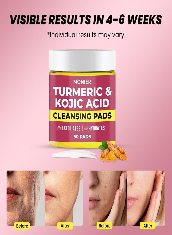 MONIER Turmeric Kojic Acid Cleansing Pads for Face Dark Spots - Hydrates & Plumps Skin - With Vitamin C & E - Sensitive Skin Friendly (50 Pads) - Image 3