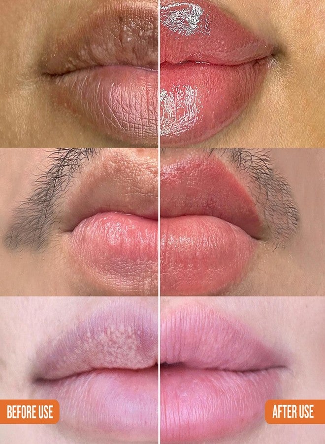 ABERA Dark Lips Corrector Cream, Lip Balm For Lightening & Brightening Dark Lips For Men & Women, Moisturizing Lip Plumper with Shea Butter,Lip Scrub, Fordyce Spot Remover (2 BOXES + GIFT) - Image 4