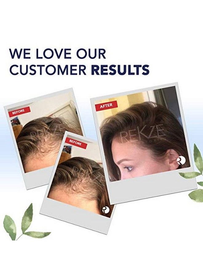 rekze - 24 Serum Treatment Clinically Proven Best Unique Regrowth Formula With 24 Premium Ingredients For Hair Thickening Antihair Loss & Thinning Hair Dht Blocker For Pattern Baldness/Alopecia - Image 1