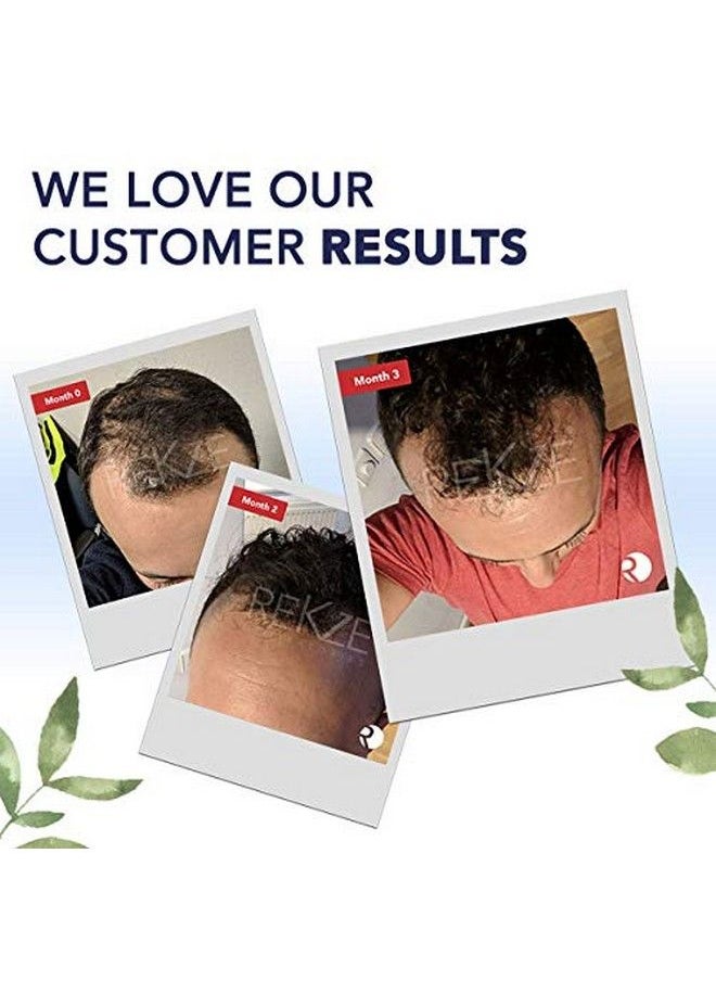 rekze - 24 Serum Treatment Clinically Proven Best Unique Regrowth Formula With 24 Premium Ingredients For Hair Thickening Antihair Loss & Thinning Hair Dht Blocker For Pattern Baldness/Alopecia - Image 1