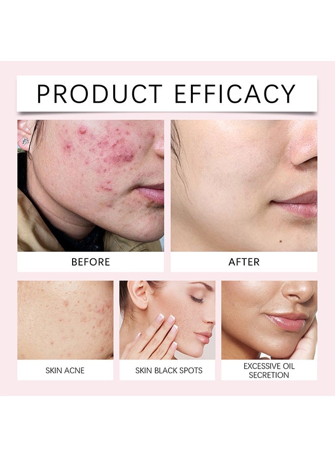 إيلهو ضمادات تنظيف حمض الكركم من كوجيك - منظف مسام الوجه لتقليل علاج حب الشباب ، محلول التقشير الكيميائي للبقع الداكنة ، البثور ، الندبات ، تقليل خطوط التجاعيد 40 قطعة - Image 4