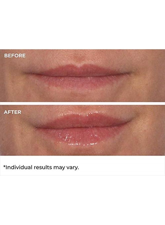 nassif md NassifMD Hydro-Screen for Lips - Image 4