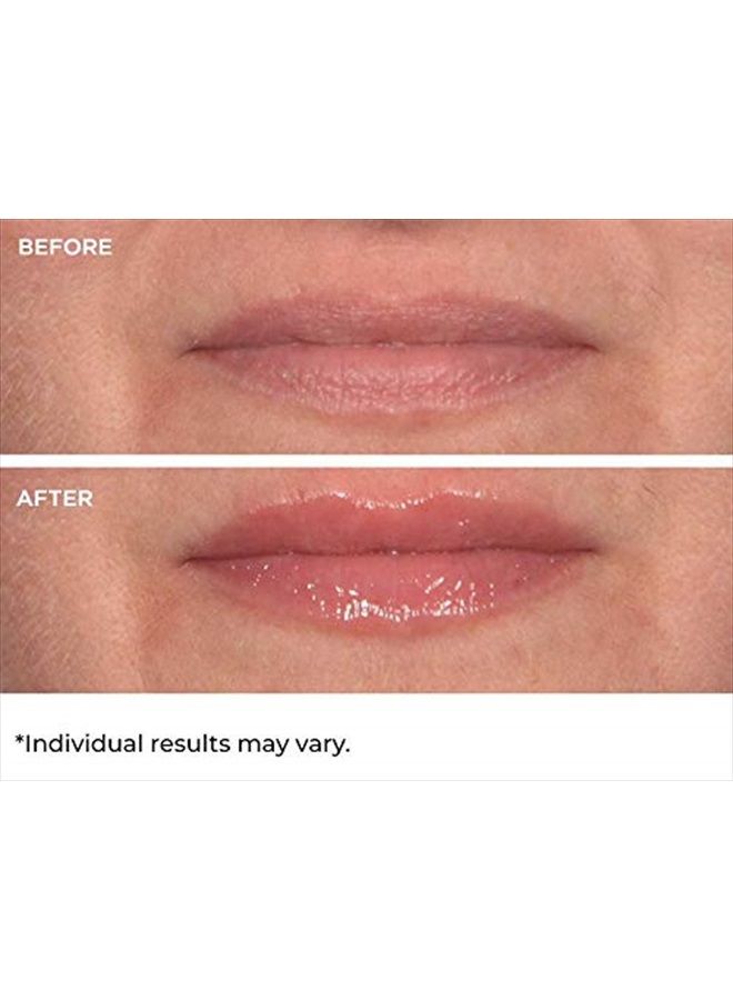 nassif md NassifMD Hydro-Screen for Lips - Image 3