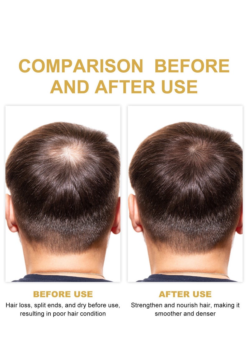 EELHOE - Hair growth oil for stimulating new hair growth rosemary oil for dry, damaged hair and hair loss - Image 1