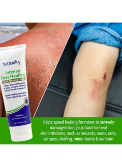 TriDerma TriDerma Intense Fast Skin Healing Cream for Hard-to-Heal Skin Irritations, Sores, Rashes, Dry, Cracked Hands, Cuts, Chafing, Burns, Scrapes - First Aid Kit Essential - FSA Eligible - 4.0 oz Tube  - Image 2