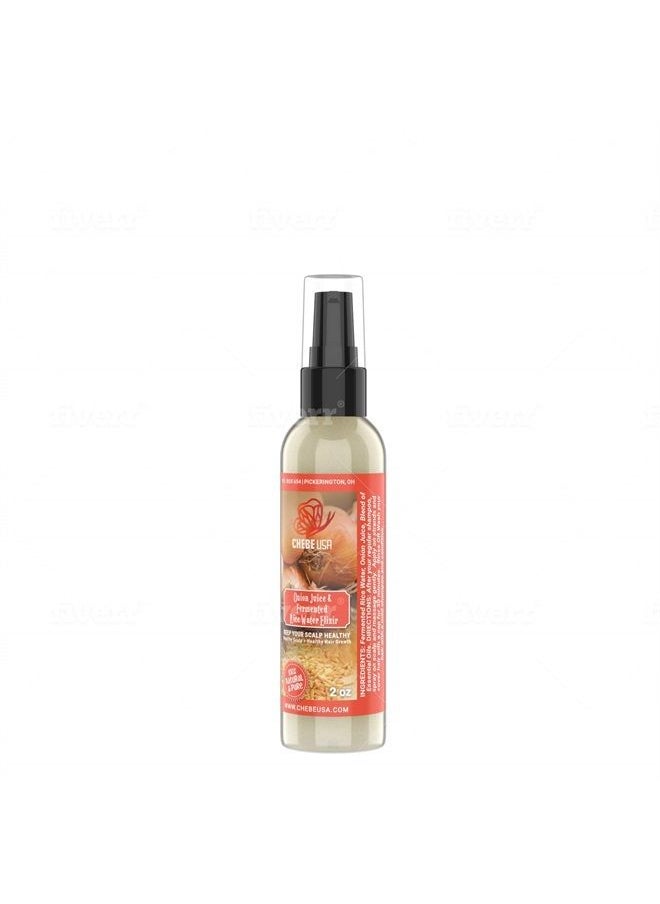 Uhuru Naturals - Onion Juice & Fermented Rice Water Elixir (Keep Your Scalp Healthy-Healthy Scalp=Healthy Hair Growth) 2oz - Image 1