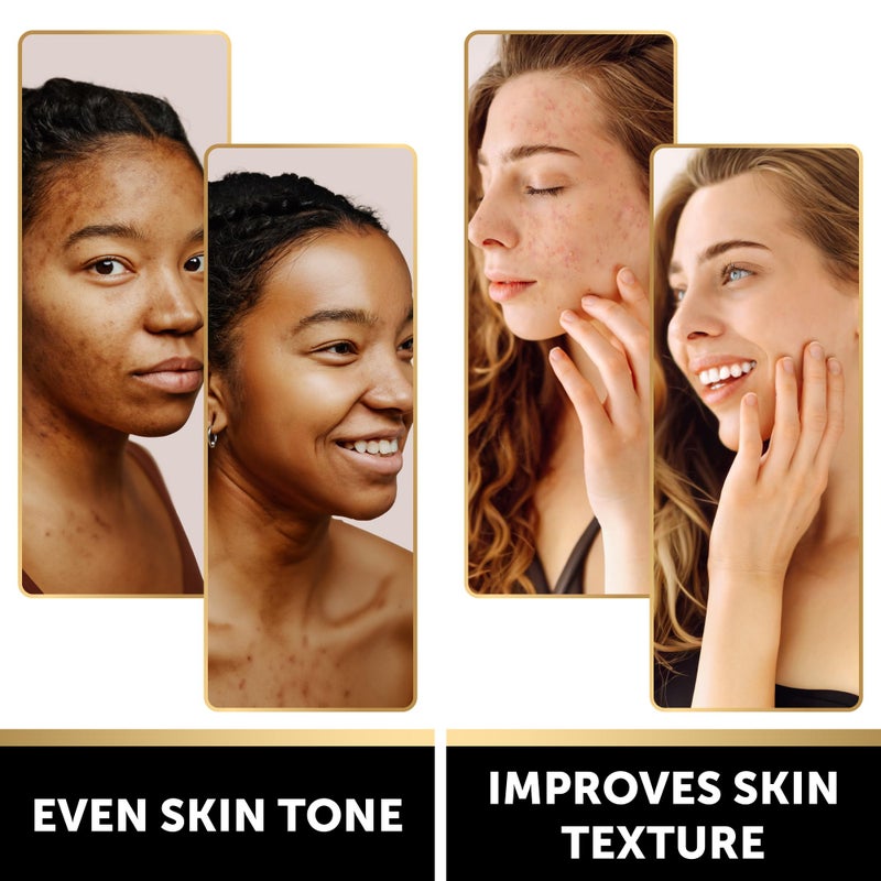 VALITIC Kojic Acid Soap Bars - Turmeric, Snail Mucin, Charcoal and Lemon - 4 Assorted Dark Spot Remover Soaps with Hyaluronic Acid, Vitamin C, Vitamin E and Shea Butter - Image 2