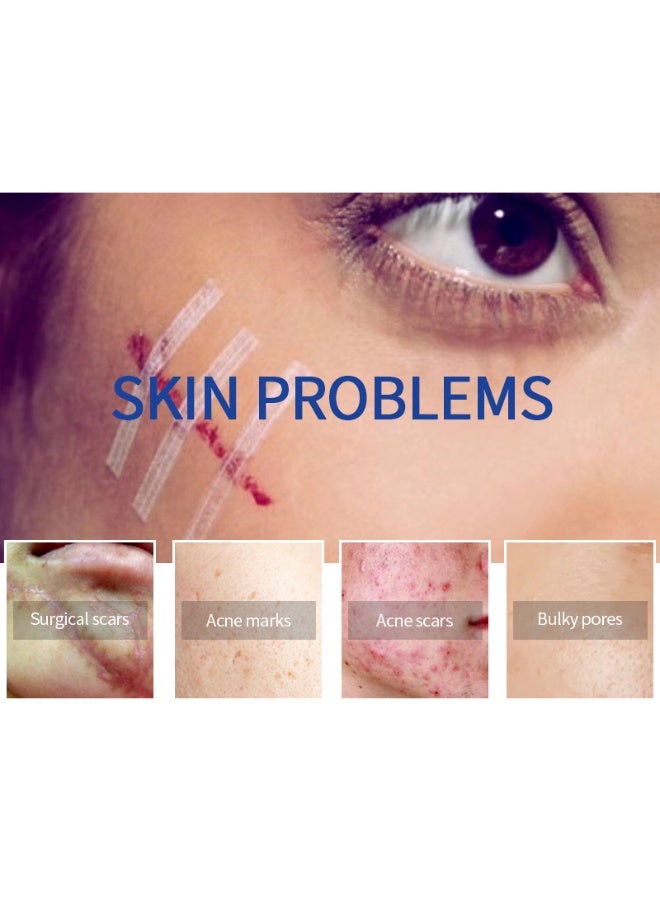 MSLAM Shark Repair Face Cream, Fades Scars and Acne Marks 30g - Image 3