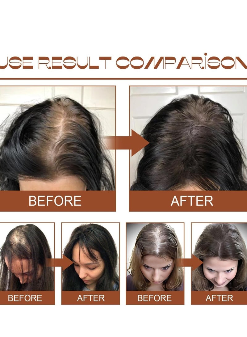Batana Oil for Hair Growth, Natural Organic Hair Conditioner, Repairs Damaged Hair, Leaves Hair Smoother, Natural Hair Growth Oil, Helps with Frizz, for All Hair Types