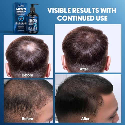 ulluxe Biotin Hair Growth Shampoo for Men: Natural Mens Thickening Shampoo for Hair Loss and Thinning Hair, Infused Rosemary Oil Tea Tree Oil and Mint, Sulfate Free and Color Safe, 10.15 fl.oz - Image 4