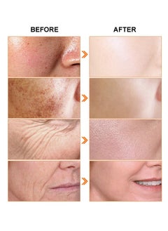 JoyPretty Day & Night Skin Care Set Vitamin C & Retinol Anti-Wrinkle Serum Gold Skincare Duo Radiance Renewal Anti-Aging Serum Moisturizing Hydrating Anti-Aging & Anti-Wrinkle Serum  - Image 3