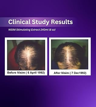 Nisim Nisim New Hair Biofactors Hair Stimulating Extract Original Formula for Oily Hair 240ml - Image 3