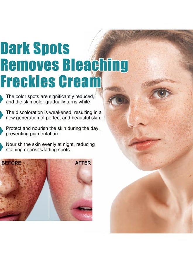 EELHOE Dark Spot Removes Bleaching Freckles Cream For Face, Fast-Acting Dark Spot Corrector Remover For Face And Body Hyperpigmentation, Fades Melasma, Freckle, Sun Spots, Evens Skin Tone, Age Spot Remover - Image 5