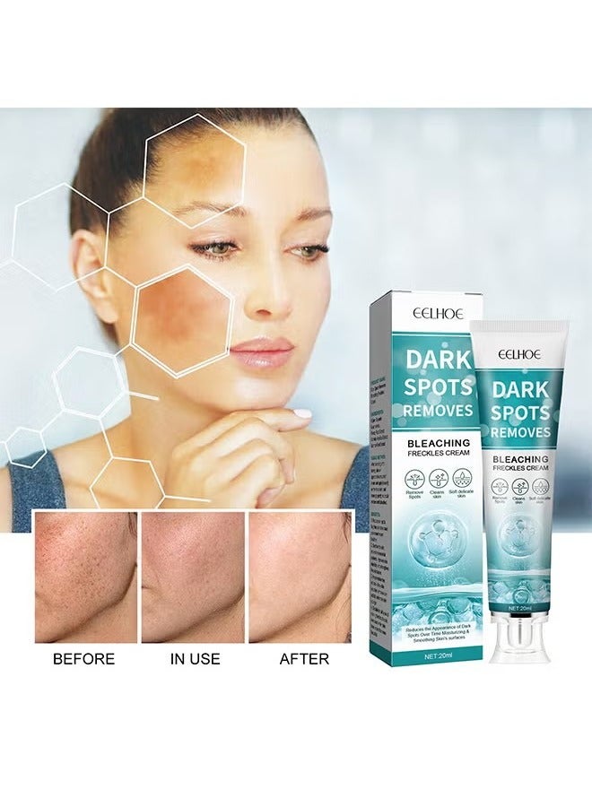 EELHOE Dark Spot Removes Bleaching Freckles Cream For Face, Fast-Acting Dark Spot Corrector Remover For Face And Body Hyperpigmentation, Fades Melasma, Freckle, Sun Spots, Evens Skin Tone, Age Spot Remover - Image 2