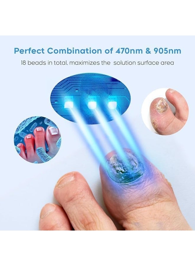 كيلا جهاز ليزر لعلاج فطريات الأظافر لأظافر القدمين واليدين المتعددة، محلول لإصلاح الأظافر التالفة والمتغيرة اللون، مناسب للاستخدام المنزلي - Image 2