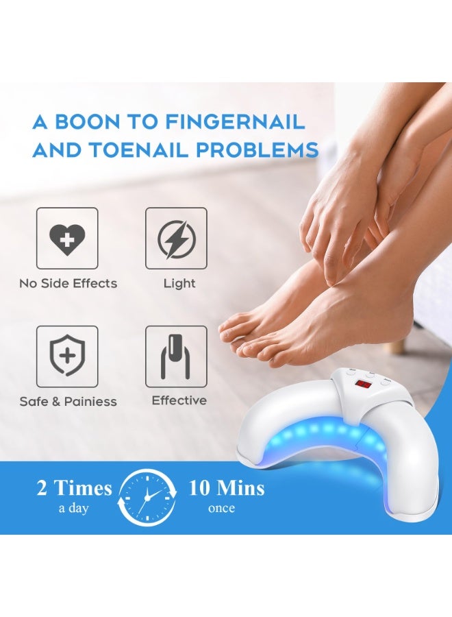 كيلا جهاز ليزر لعلاج فطريات الأظافر لأظافر القدمين واليدين المتعددة، محلول لإصلاح الأظافر التالفة والمتغيرة اللون، مناسب للاستخدام المنزلي - Image 4