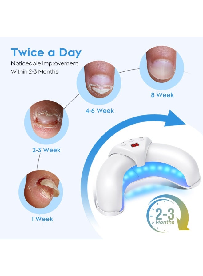 كيلا جهاز ليزر لعلاج فطريات الأظافر لأظافر القدمين واليدين المتعددة، محلول لإصلاح الأظافر التالفة والمتغيرة اللون، مناسب للاستخدام المنزلي - Image 5