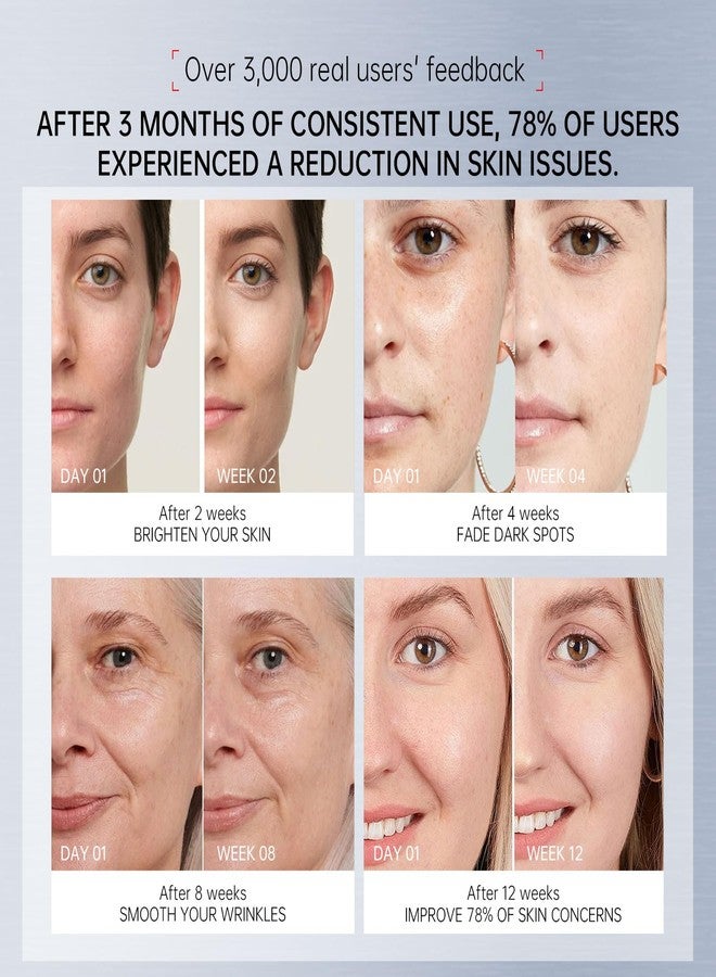 VGO Anti Aging Skin Care Set - Vitamin C & Retinol Serum for Face with Hyaluronic Acid, Niacinamide, and Retinol Anti Wrinkle and Firming 1.56oz - Image 3