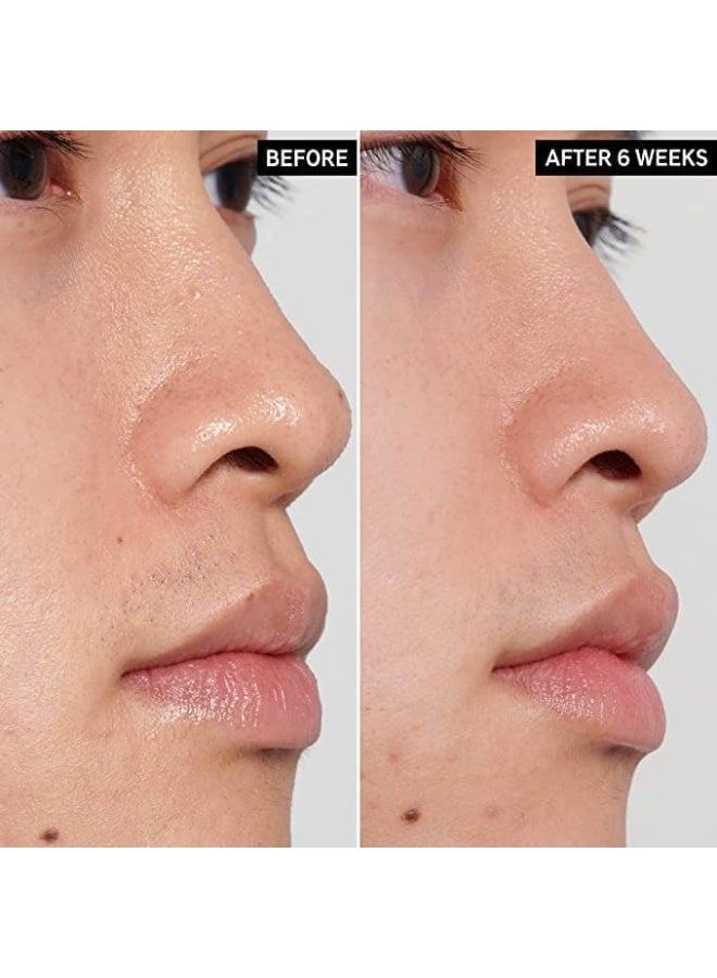 تونر بولي هيدروكسي PHA بتركيز 3% ونياسيناميد 3% لتحسين ملليلترمس البشرة بلطف من ذي انكي ليست 100 ملليلتر لنوع حساسة للجنسين اونصة 3.38 - Image 3