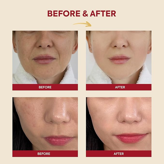 K-SECRET SEOUL1988 Essence : Snail Mucin 97% + Rice - Image 4