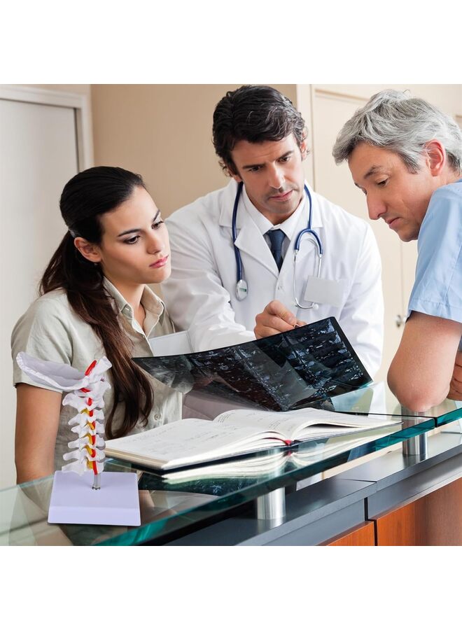 LAMAY Cervical Spine Model, 1:1 Life Size Anatomical Cervical Spine Model Showing Spinal Nerves and Arteries, Ideal Tool For Medical Teaching Anatomy Research Patient Teaching - Image 5