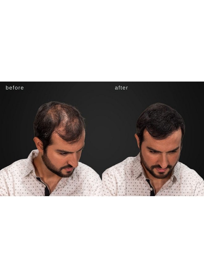 LUXE Professional Luxe Hair Thickening Fibers Confidence In A Jar 2 Months+ Supply! Hypoallergenic Dermatologist Tested Multiple Colors Available (Blond) - Image 5