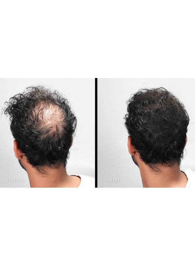 LUXE Professional Luxe Hair Thickening Fibers Confidence In A Jar 2 Months+ Supply! Hypoallergenic Dermatologist Tested Multiple Colors Available (Blond) - Image 3