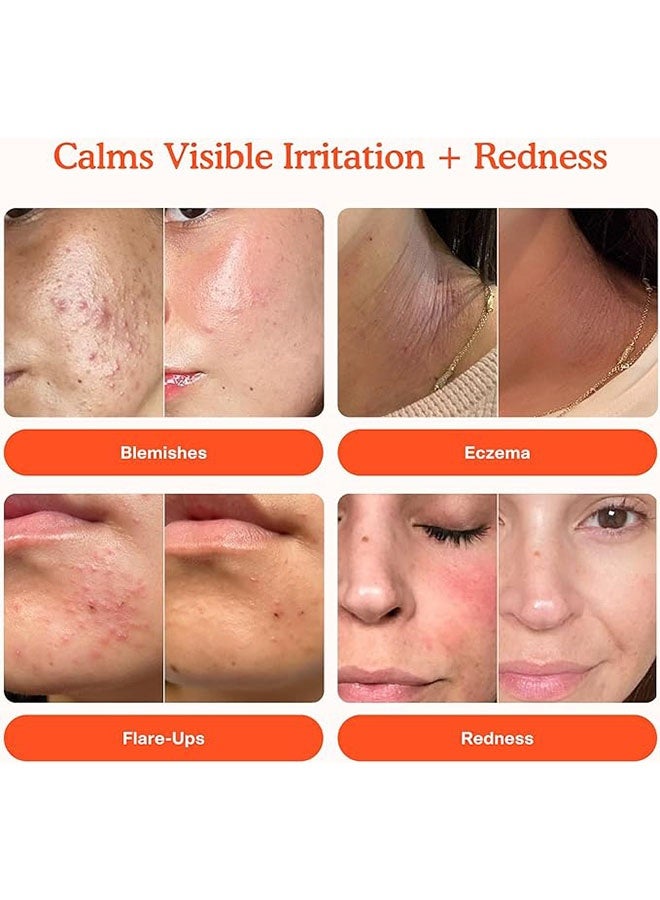 TOWER 28 Daily Rescue Facial Spray 120ml, Soothing and Refreshing pH Balancing Toner, Hypochlorous Acid Designed for Sensitive Skin - Image 2