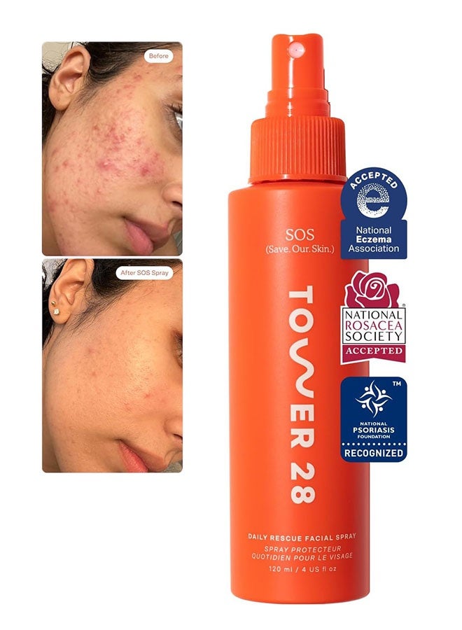 TOWER 28 Daily Rescue Facial Spray 120ml, Soothing and Refreshing pH Balancing Toner, Hypochlorous Acid Designed for Sensitive Skin - Image 1