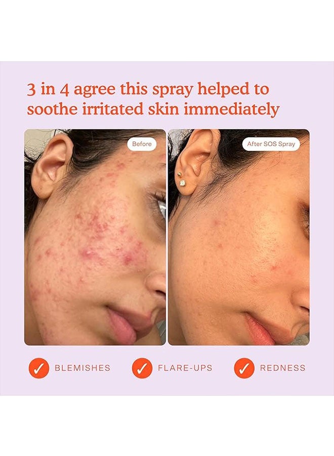 TOWER 28 Daily Rescue Facial Spray 120ml, Soothing and Refreshing pH Balancing Toner, Hypochlorous Acid Designed for Sensitive Skin - Image 4