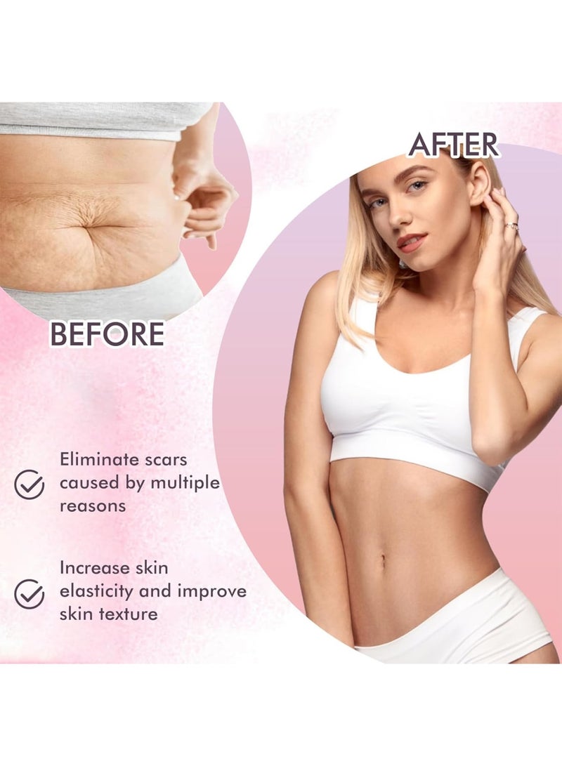 SOLARAE Skin Care Oil, Stretch Mark Pregnancy Massage Oil with Vitamin E, Safe ingredients, Moisturize Face and Body, Increase Skin Elasticity, Eliminate Injury,Surgical Scars, Improve Skin Texture, 120 ML - Image 4