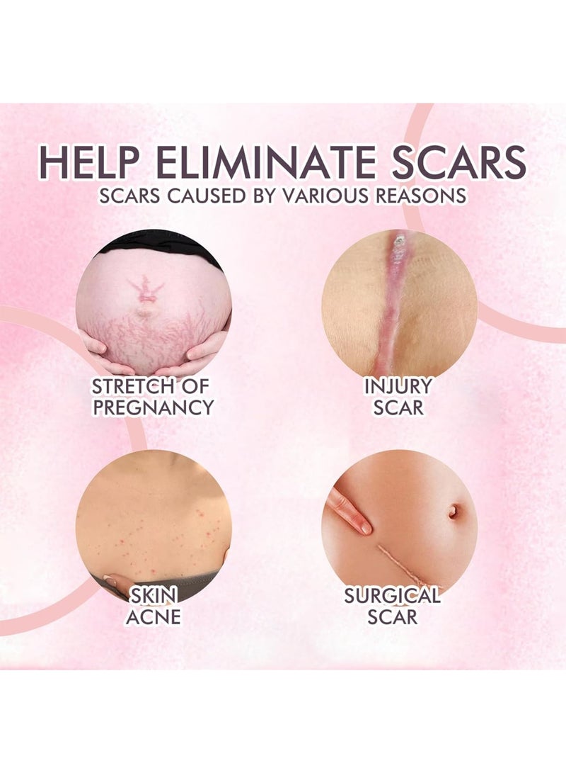 SOLARAE Skin Care Oil, Stretch Mark Pregnancy Massage Oil with Vitamin E, Safe ingredients, Moisturize Face and Body, Increase Skin Elasticity, Eliminate Injury,Surgical Scars, Improve Skin Texture, 120 ML - Image 3