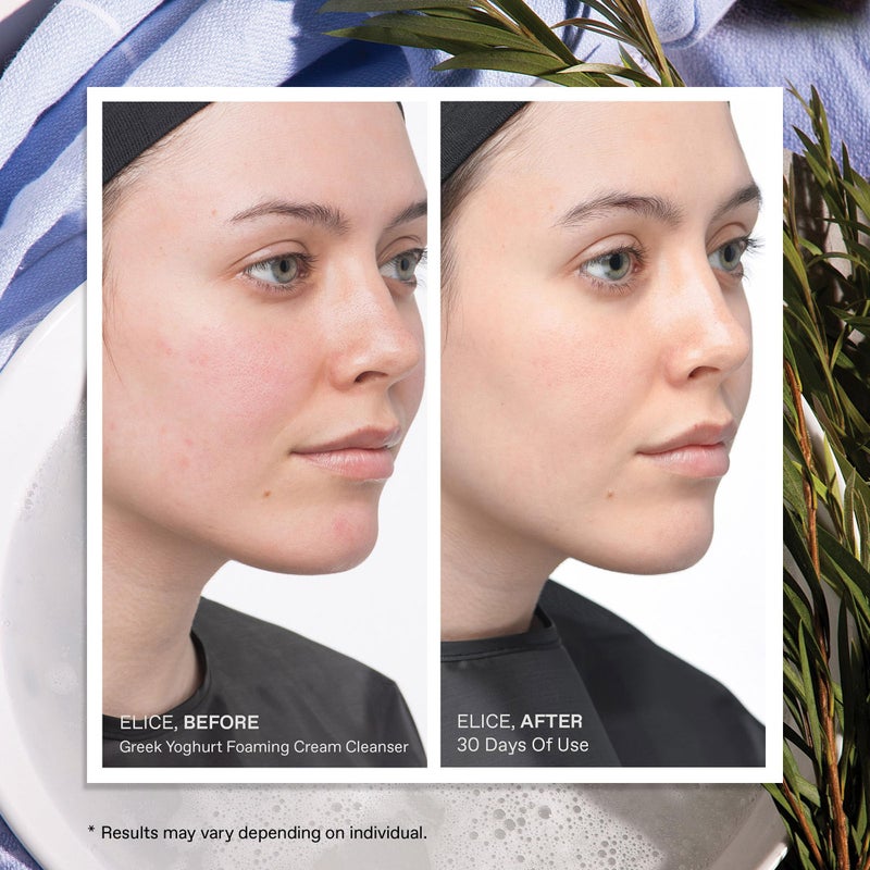 KORRES Greek Yoghurt Foaming Cream Cleanser, Hydrating, Deep Cleansing Skin Care, Makeup Remover, Face Wash for Women, Cream to Foam Facial Cleanser for Dry, Oily, Sensitive, Any Skin Type, 2.5 fl oz - Image 5