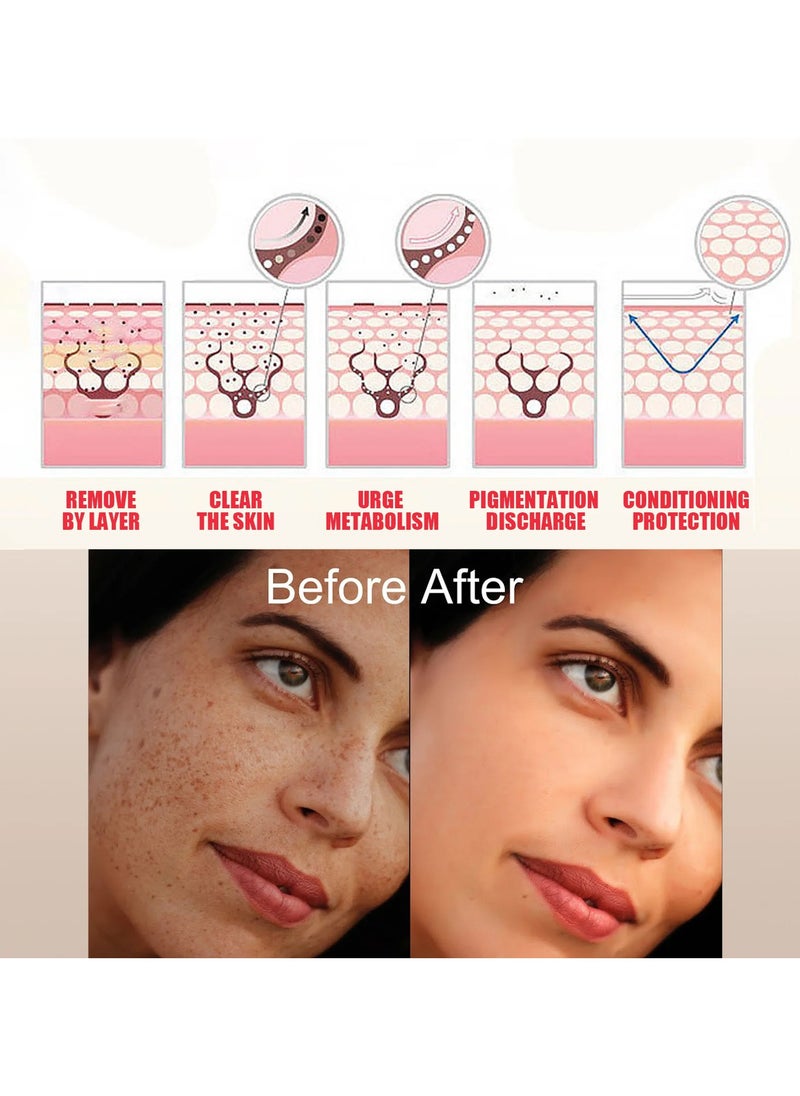 EELHOE - Whitening repair pigmentation serum, melasma brightening, dark spots, anti-aging, freckle, melasma removal, freckles - Image 1