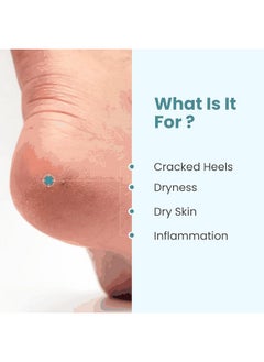 Generic Khadi Herbal Foot Care Cream Repairs Cracked Heel | Crack Heel Repair Cream For Women & Men  - Image 4