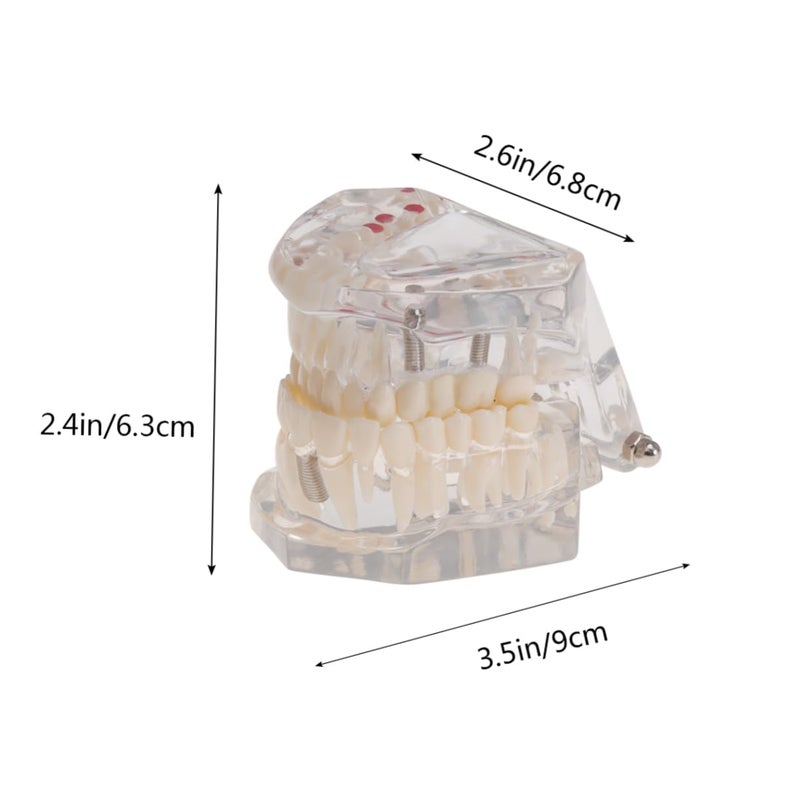 Dental Teaching Model Practice Teeth Oral Teeth Model For Students Patients - Image 3