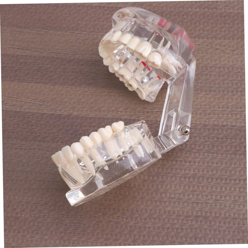 Dental Teaching Model Practice Teeth Oral Teeth Model For Students Patients - Image 5