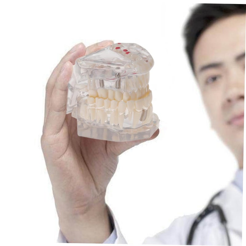 Dental Teaching Model Practice Teeth Oral Teeth Model For Students Patients - Image 4