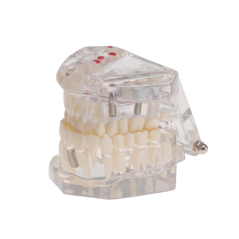Dental Teaching Model Practice Teeth Oral Teeth Model For Students Patients - Image 1