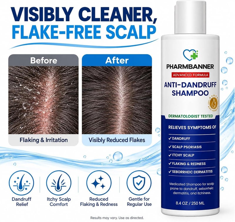 PHARMBANNER Anti-Fungal Shampoo for Folliculitis, Seborrheic Dermatitis, Scalp Psoriasis - Relieves Itchy & Dry Scalp - Image 3