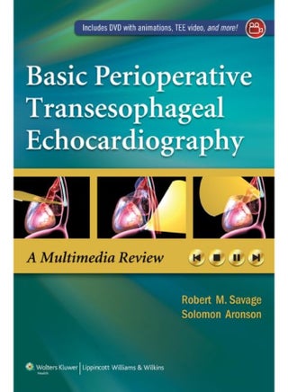Basic Perioperative Transesophageal Echocardiograp - pzsku/Z4499B90B3107CD4658B2Z/45/_/1726144849/0ebb2972-aa38-4867-a3b4-6cd6ec7e9fb4