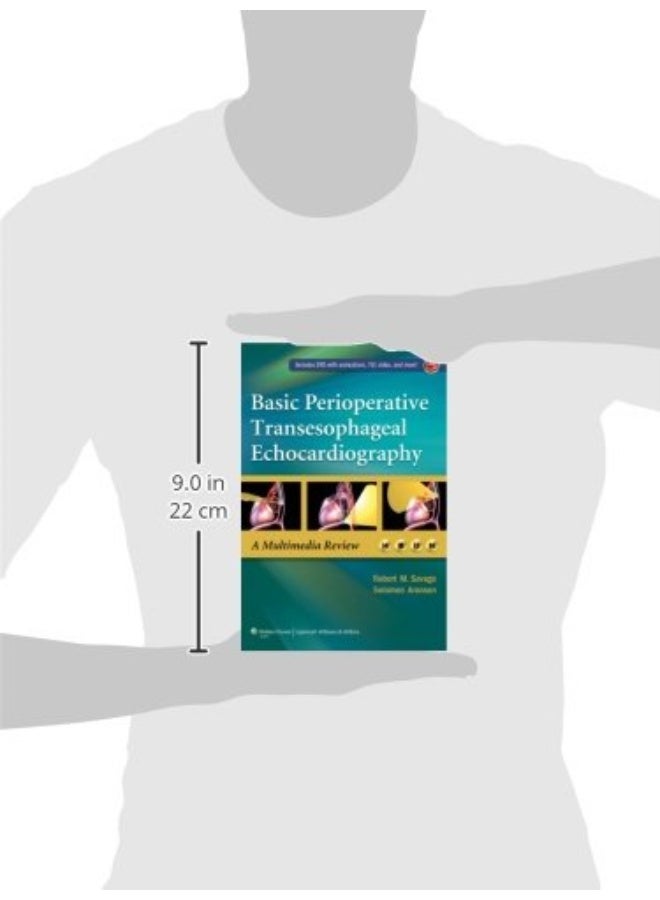 Basic Perioperative Transesophageal Echocardiograp