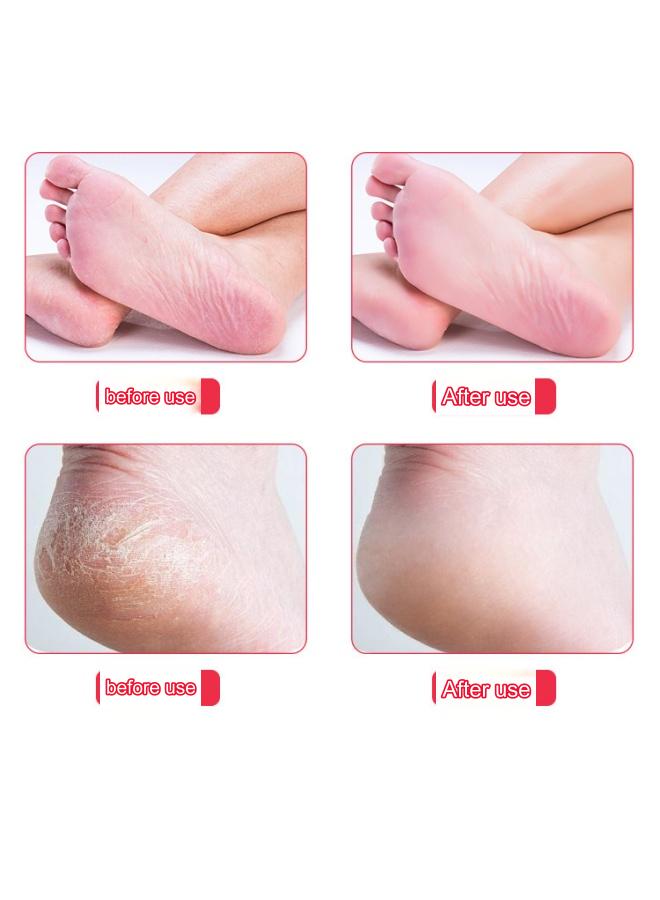 مبرد باديكير، أداة تنظيف القدمين، منظف القدمين على الوجهين، باديكير مسامير القدم لإزالة الجلد الميت، مطحنة القدم - Image 4