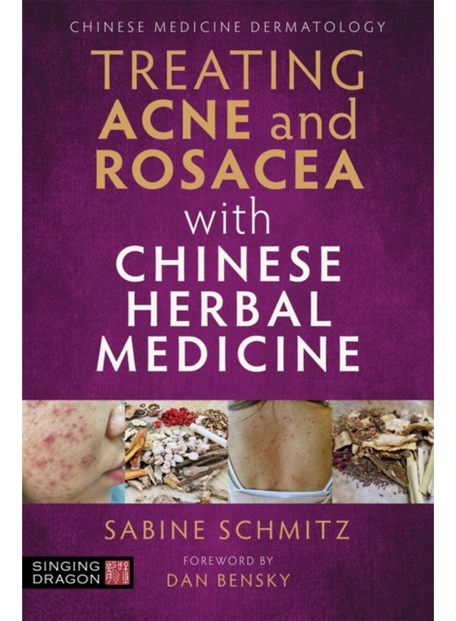 Treating Acne and Rosacea with Chinese Herbal Medicine - Paperback
