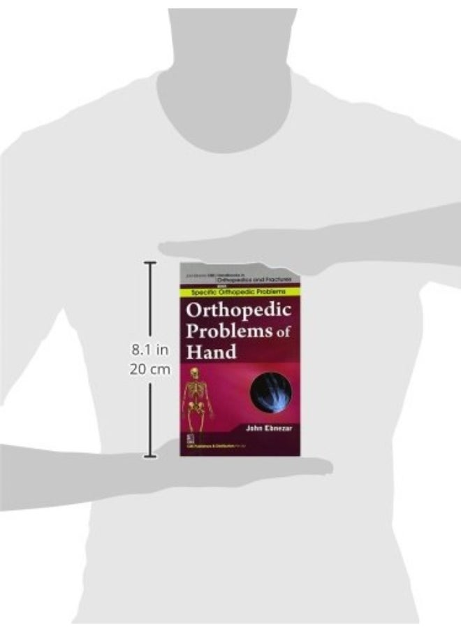 John Ebnezar CBS Handbooks in Orthopedics and Factures: Specific Orthopedic Problems: Orthopedic Problems of Hand  - Image 2