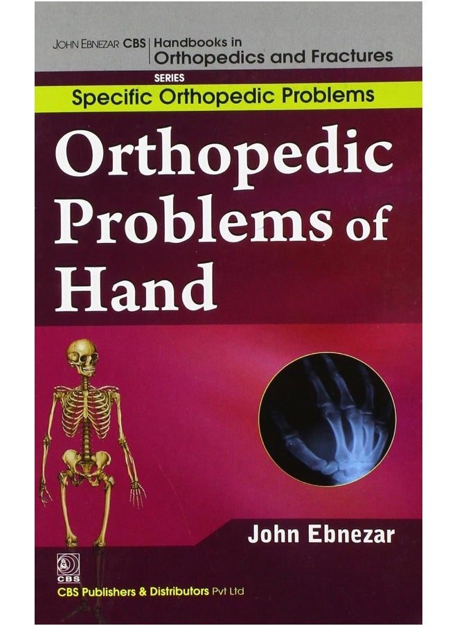 John Ebnezar CBS Handbooks in Orthopedics and Factures: Specific Orthopedic Problems: Orthopedic Problems of Hand  - Image 1